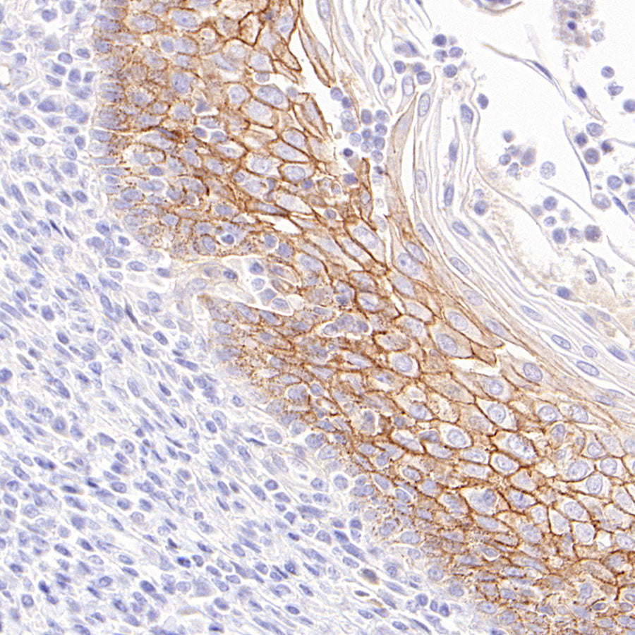 Desmoglein 3 Recombinant Rabbit mAb (SDT-3213-33)