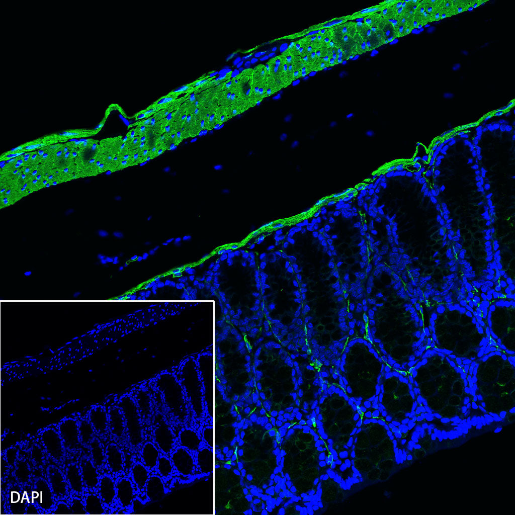 alpha smooth muscle Actin (SMA) Recombinant Rabbit mAb,PBS Only (SDT-132-63)