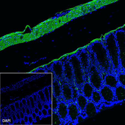 alpha smooth muscle Actin (SMA) Recombinant Rabbit mAb,PBS Only (SDT-132-63)