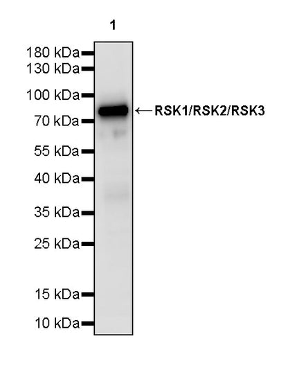 RSK1/RSK2/RSK3 Recombinant Rabbit mAb (S-4982)