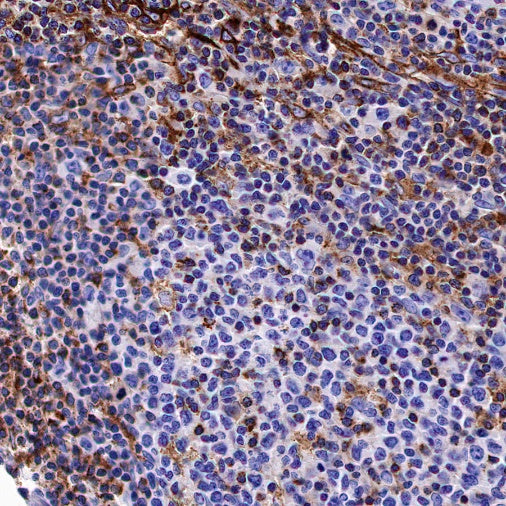 VISTA Recombinant Rabbit mAb (S-1469-72)