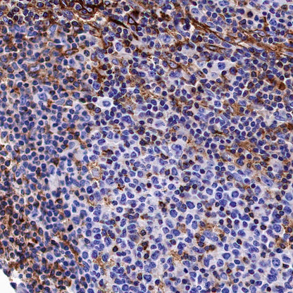 VISTA Recombinant Rabbit mAb (S-1469-72)