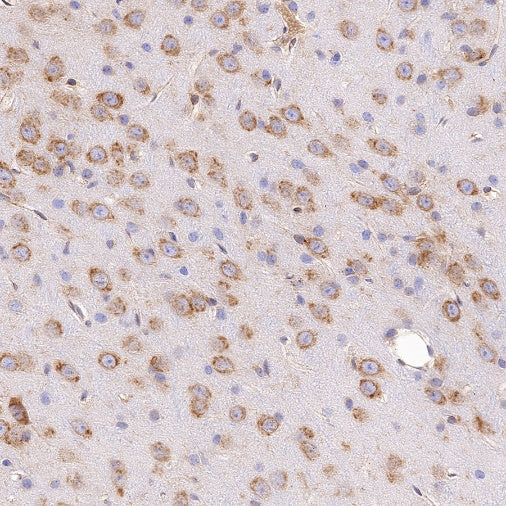 UGGT1 Recombinant Rabbit mAb (S-1079-19)