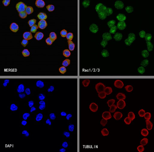 Rac1/2/3 Recombinant Rabbit mAb (S-2720-10)