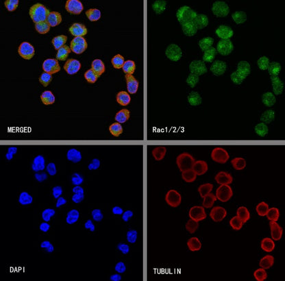 Rac1/2/3 Recombinant Rabbit mAb (S-2720-10)
