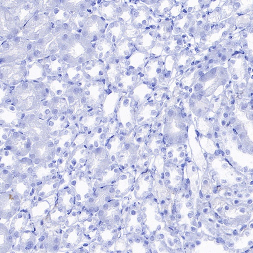 CD86 Recombinant Rabbit mAb (S-4222)