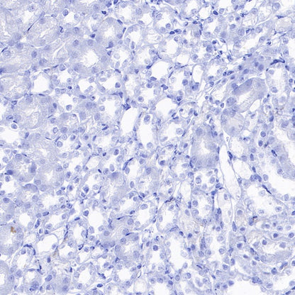 CD86 Recombinant Rabbit mAb (S-4222)