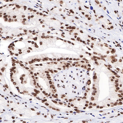 TDP43 Recombinant Rabbit mAb (S-R354)