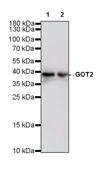 GOT2 Recombinant Rabbit mAb