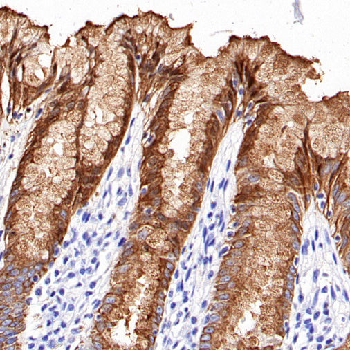 TFF1 Recombinant Rabbit mAb (S-336-75)
