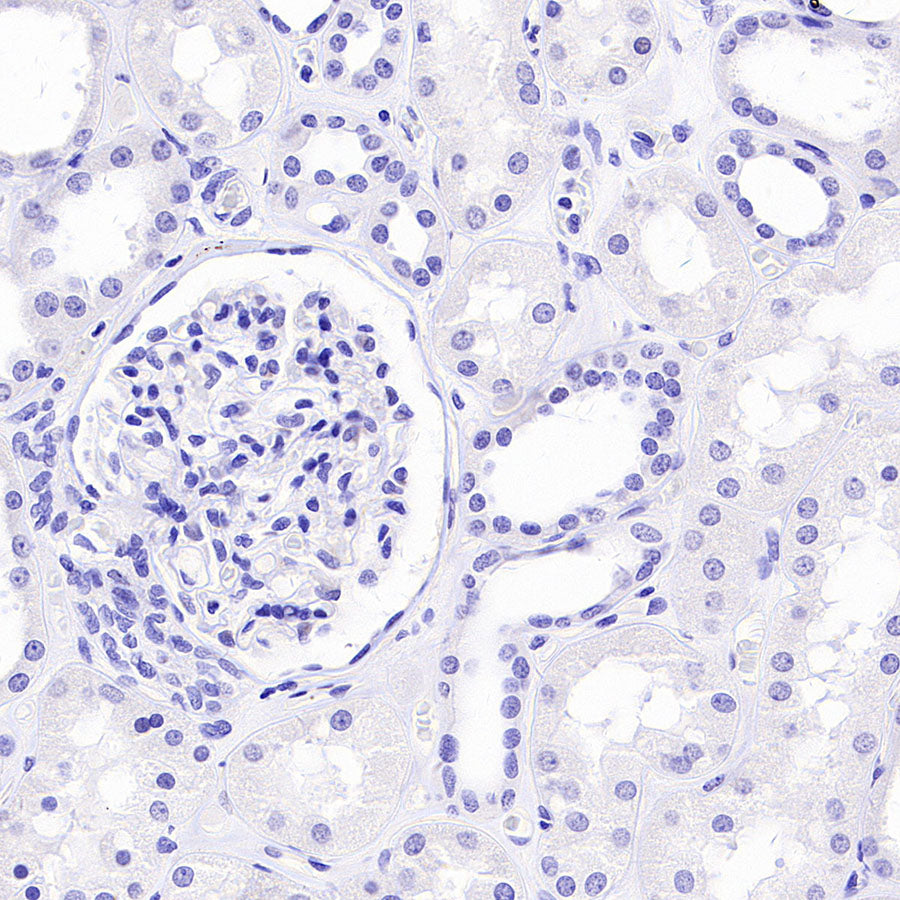 PAM Recombinant Rabbit mAb (SDT-2995-30)