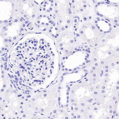 PAM Recombinant Rabbit mAb (SDT-2995-30)