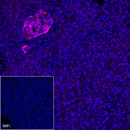 CD99 Recombinant Rabbit mAb (Alexa Fluor® 647 Conjugate) (S-R122)