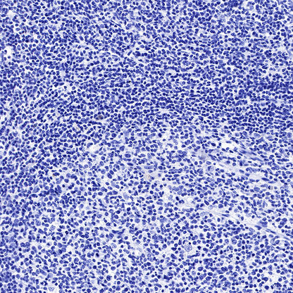 Progesterone Receptor Recombinant Rabbit mAb (SDT-R123)