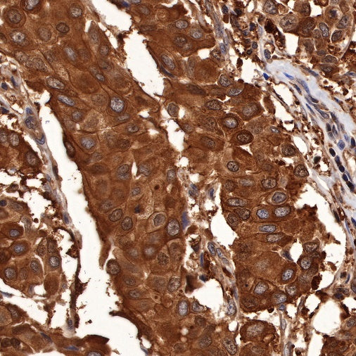 p38 MAPK Recombinant Rabbit mAb (S-508-19)