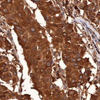 p38 MAPK Recombinant Rabbit mAb (S-508-19)