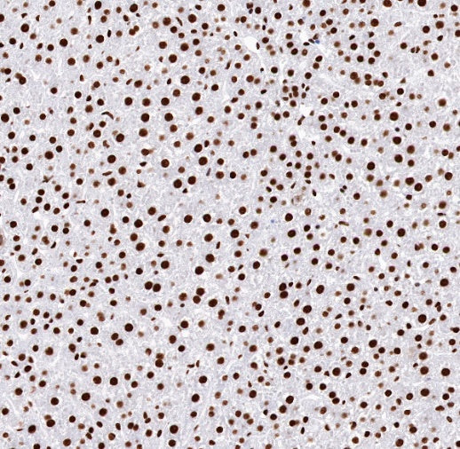 TDP-43 Recombinant Rabbit mAb (S-989-41)