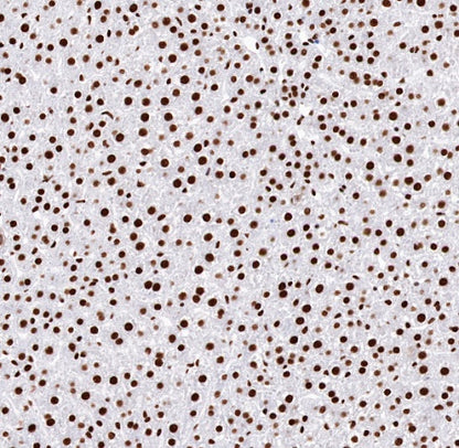TDP-43 Recombinant Rabbit mAb (S-989-41)