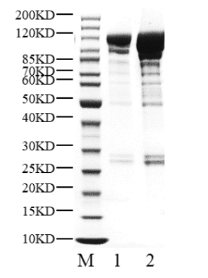 PRKD1 Protein, Human