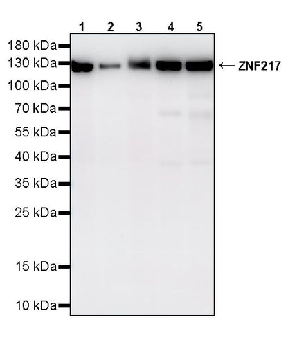 ZNF217 Recombinant Rabbit mAb (S-4699-14)