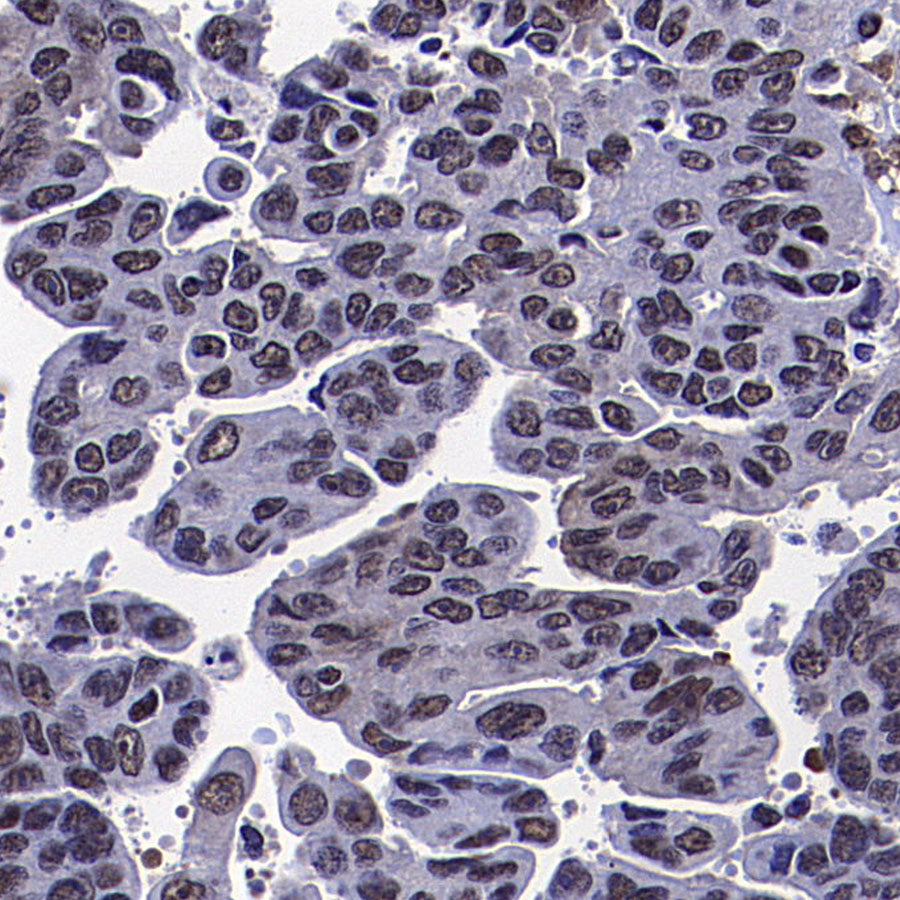 Caspase-8 Recombinant Rabbit mAb (S-2676-121)