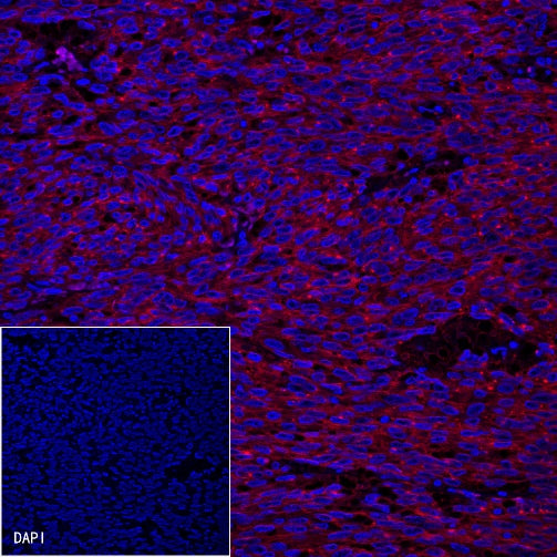 CD117 Recombinant Rabbit mAb (Alexa Fluor® 594 Conjugate) (S-125-51)