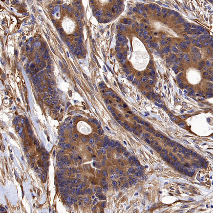 BCAR1 Recombinant Rabbit mAb (S-3542-49)