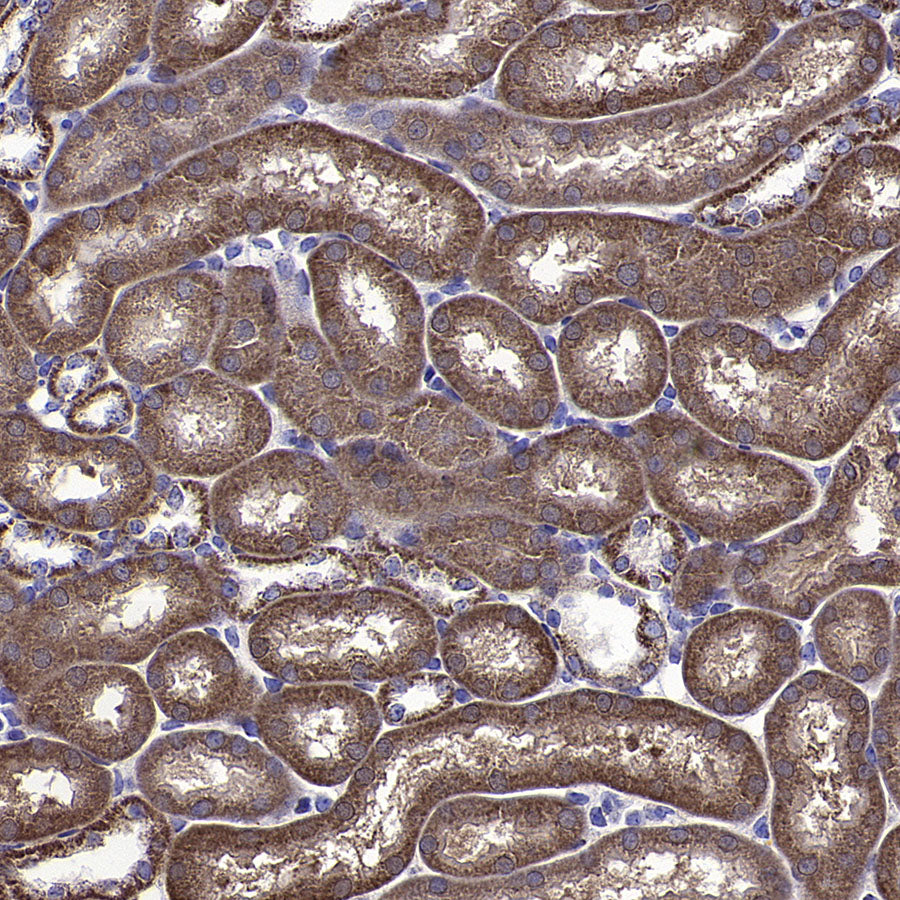 CYTB Recombinant Rabbit mAb (S-3877-15)