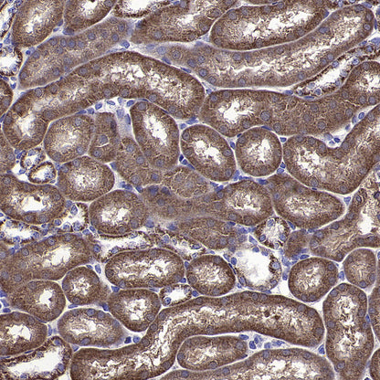 CYTB Recombinant Rabbit mAb (S-3877-15)