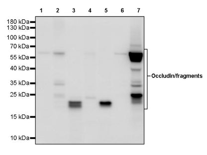 Occludin Recombinant Rabbit mAb (SDT-4588)