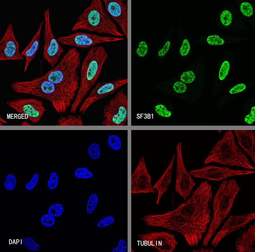 SF3B1 Rabbit Polyclonal Antibody