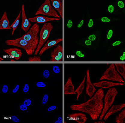 SF3B1 Rabbit Polyclonal Antibody