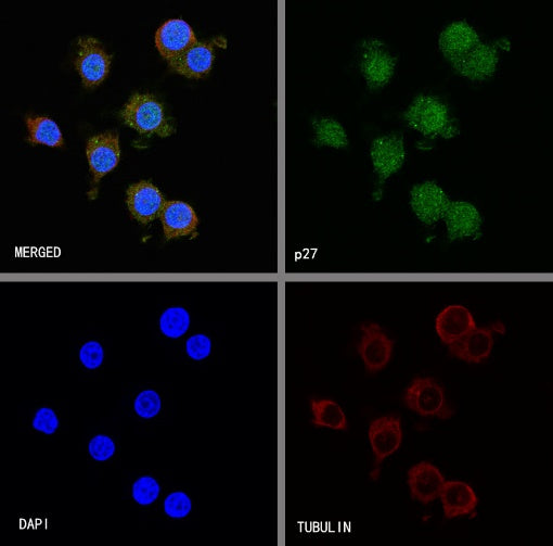 p27 Recombinant Rabbit mAb (SDT-R350)