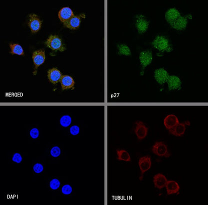 p27 Recombinant Rabbit mAb (SDT-R350)