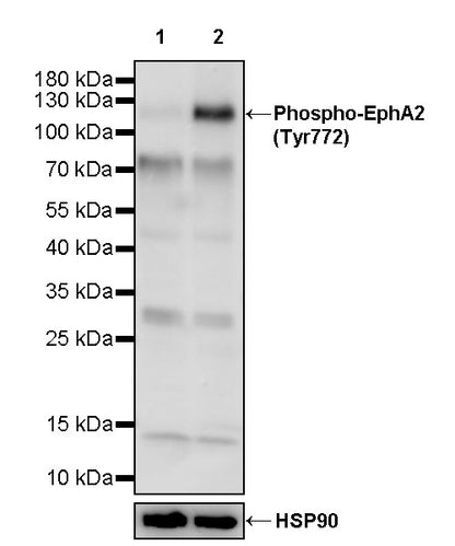 Phospho-EphA2 (Tyr772) Recombinant Rabbit mAb (S-3525-94)