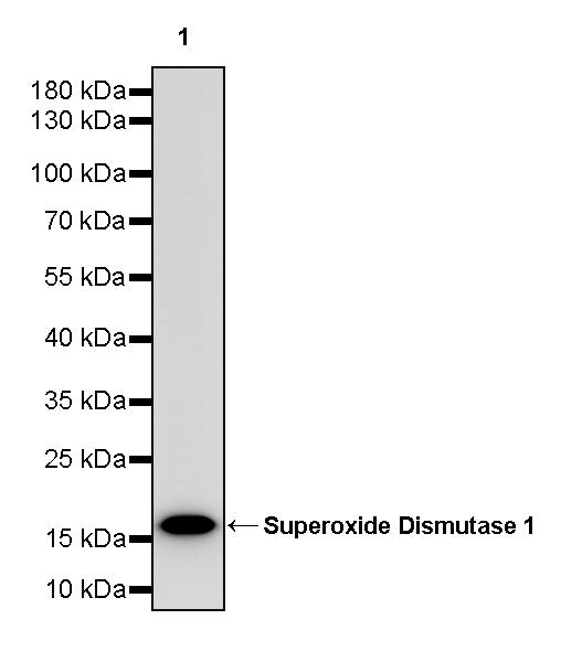 Superoxide Dismutase 1 Recombinant Rabbit mAb (S-1537-39)