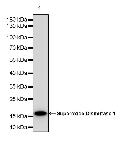 Superoxide Dismutase 1 Recombinant Rabbit mAb (S-1537-39)