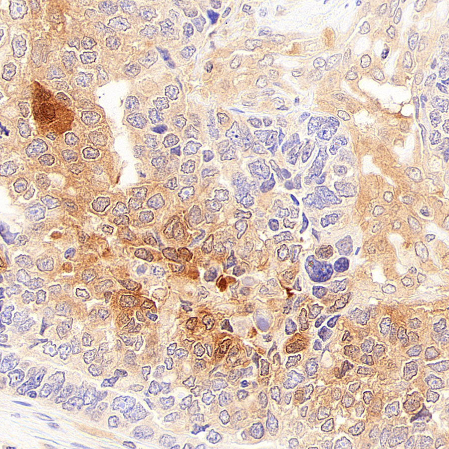Rad51C Recombinant Rabbit mAb (S-4505-32)