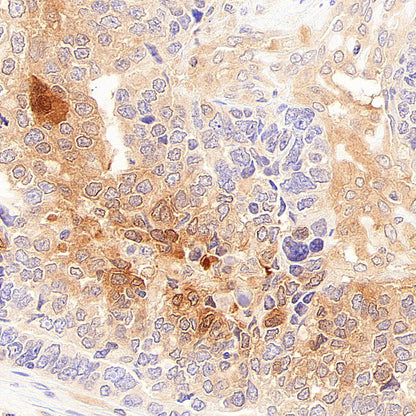 Rad51C Recombinant Rabbit mAb (S-4505-32)