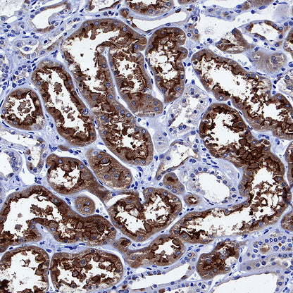 KIRREL2 Recombinant Rabbit mAb (S-4624-78)