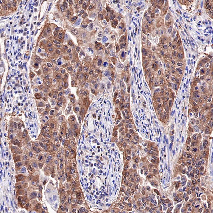 Hsp90 beta Recombinant Rabbit mAb (SDT-359-59)