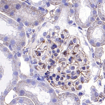 VE-Cadherin Recombinant Rabbit mAb (S-1291-239)