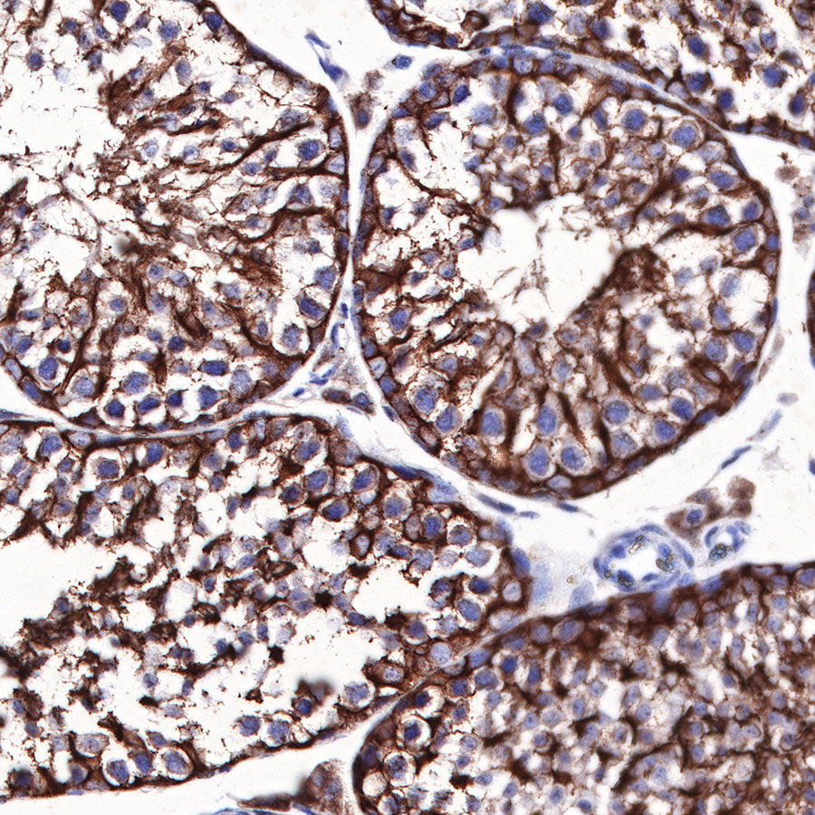 Beta III tubulin Recombinant Rabbit mAb (SDT-251-28)
