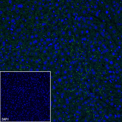 MDR3 Recombinant Rabbit mAb (SDT-1949-60)