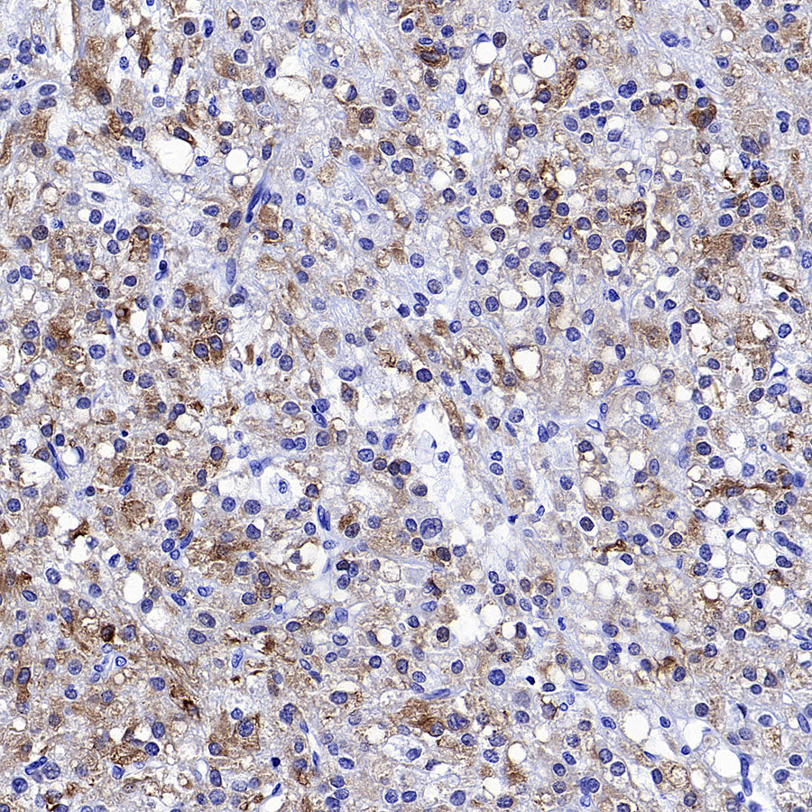 Inhibin alpha Recombinant Rabbit mAb (SDT-3212-24)