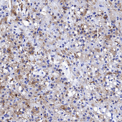 Inhibin alpha Recombinant Rabbit mAb (SDT-3212-24)