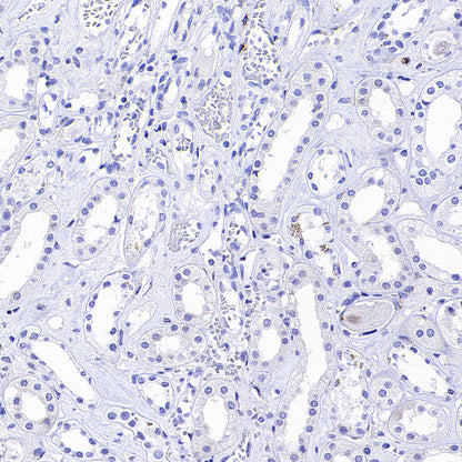 Glypican-3 Recombinant Rabbit mAb (SDT-4064-69)