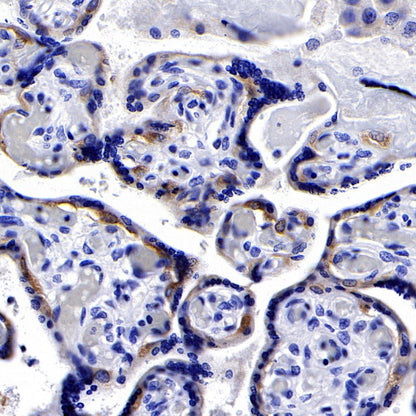 PEG10 Recombinant Rabbit mAb (SDT-442-60)