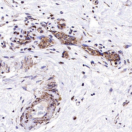 Fumarate hydratase Recombinant Rabbit mAb, PBS Only (SDT-2434-54)