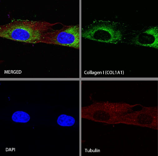 S-RMab® Collagen I (COL1A1) Recombinant Rabbit mAb (S-463-3)